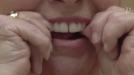 Get a New Smile in a Snap